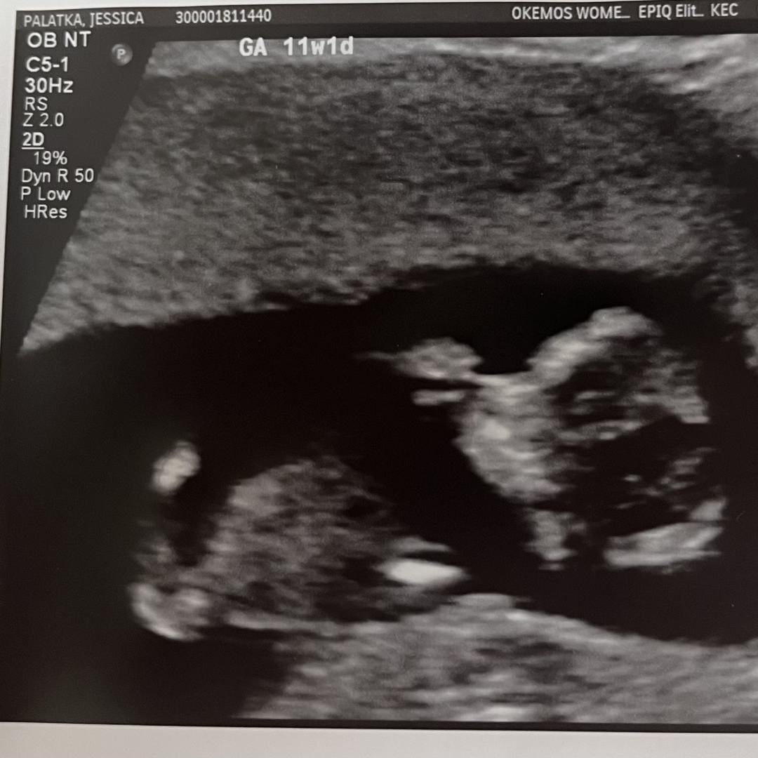 Photo shared by Jessica for their Babylist baby registry.