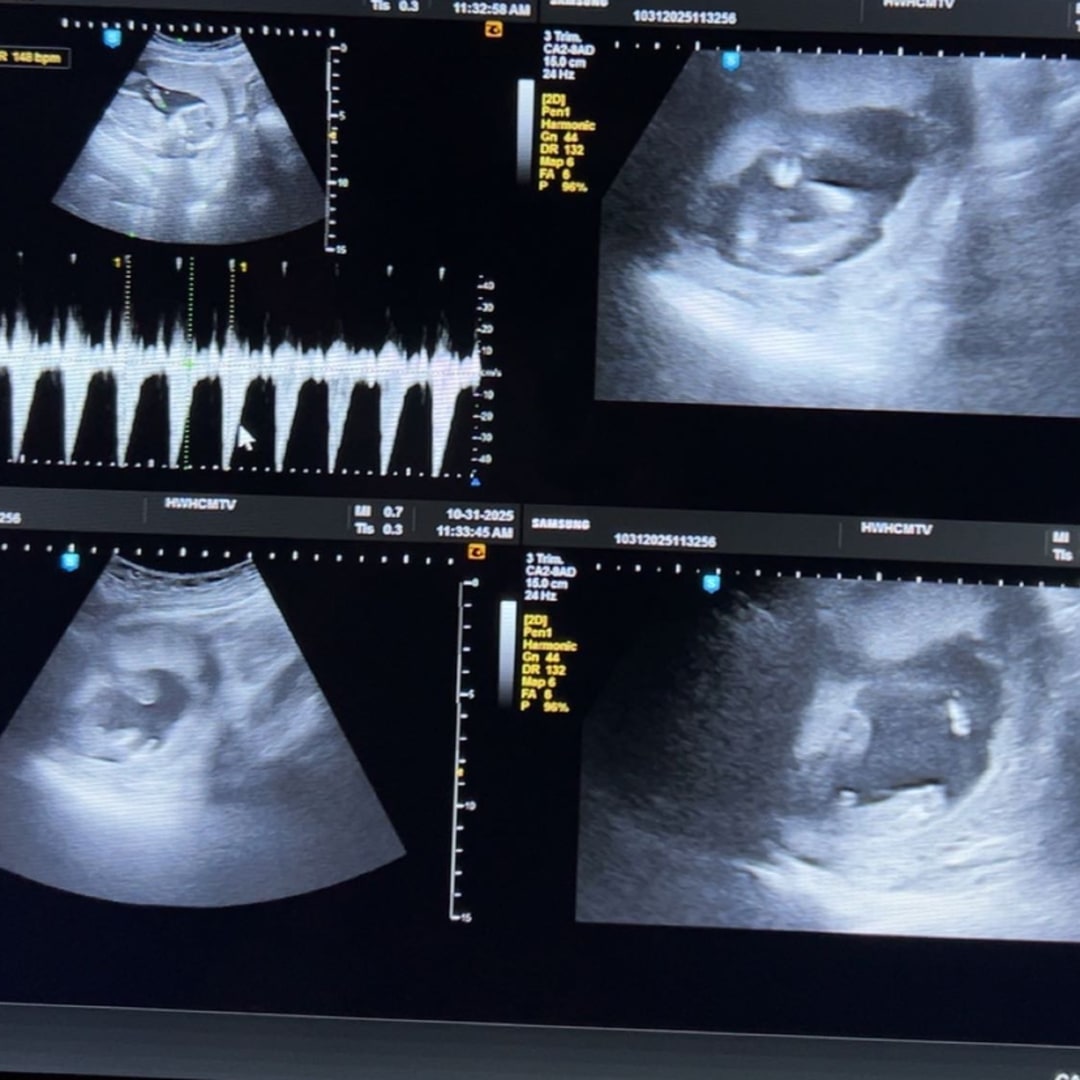 Photo shared by Chandra for their Babylist baby registry.