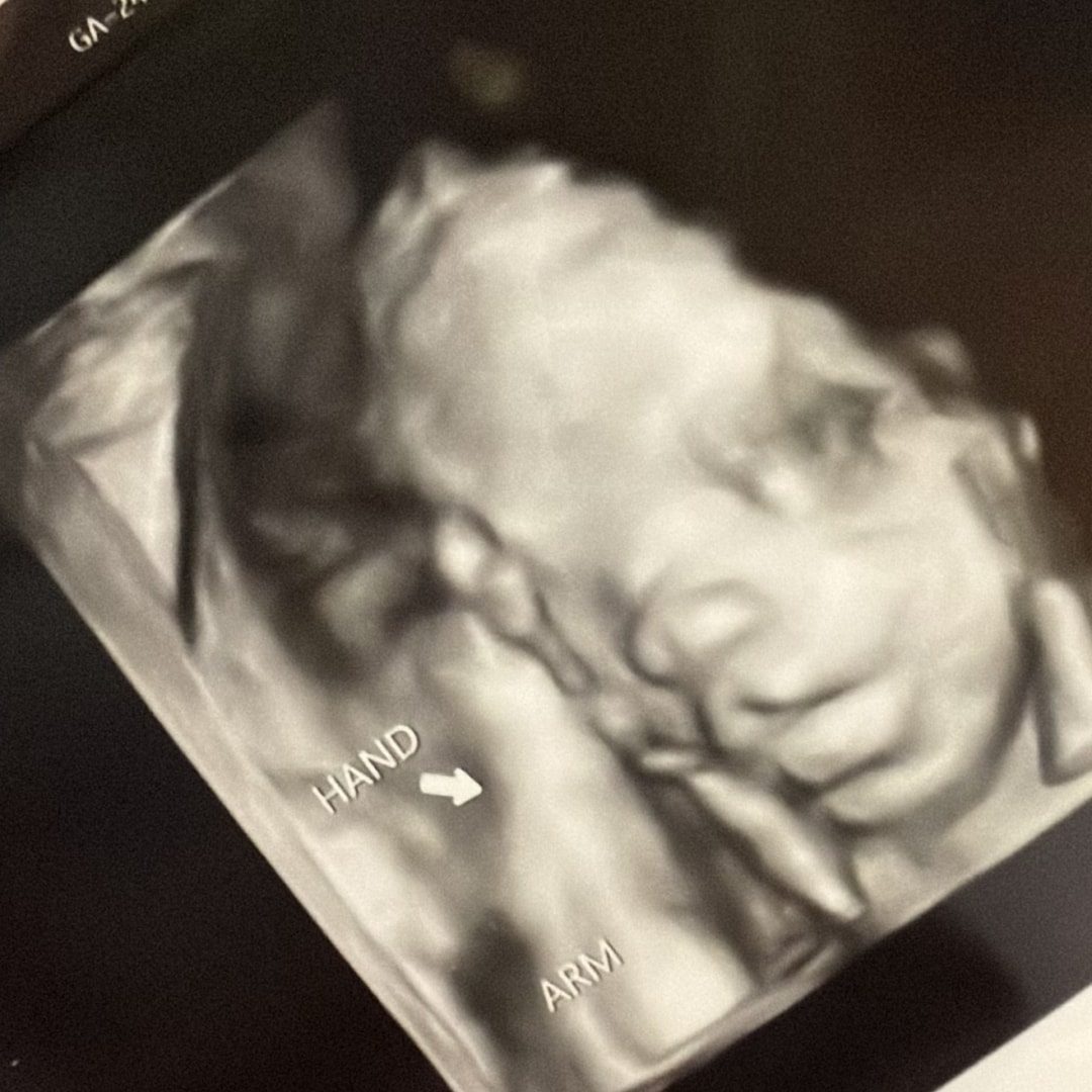 Photo shared by Calaybra for their Babylist baby registry.