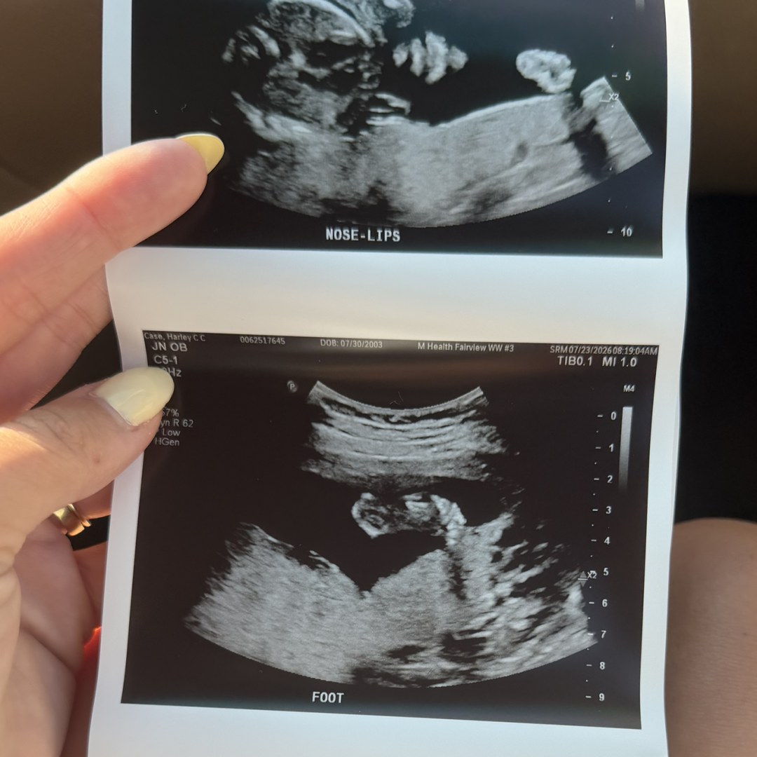 Photo shared by Harley for their Babylist baby registry.