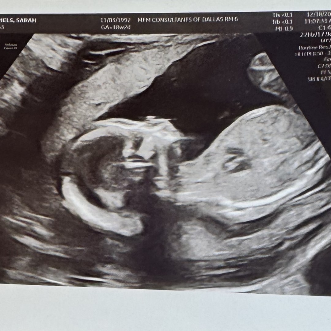 Photo shared by Sarah for their Babylist baby registry.