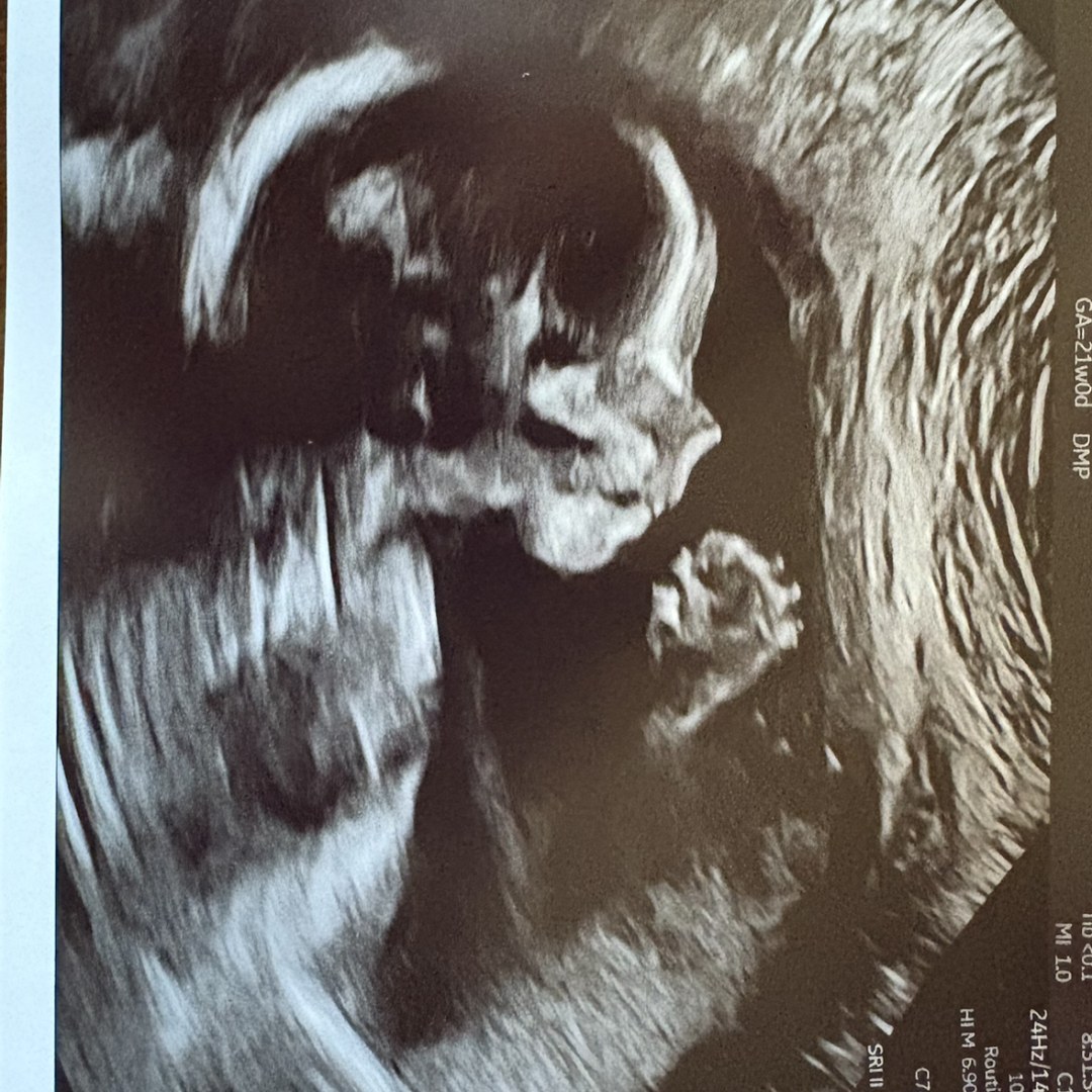 Photo shared by Chelsea for their Babylist baby registry.