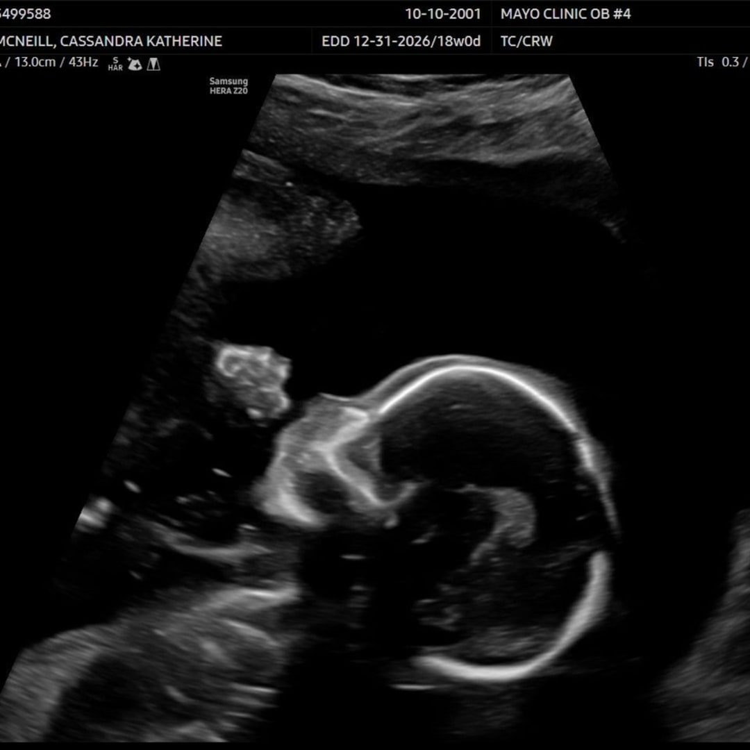 Photo shared by Cassi for their Babylist baby registry.