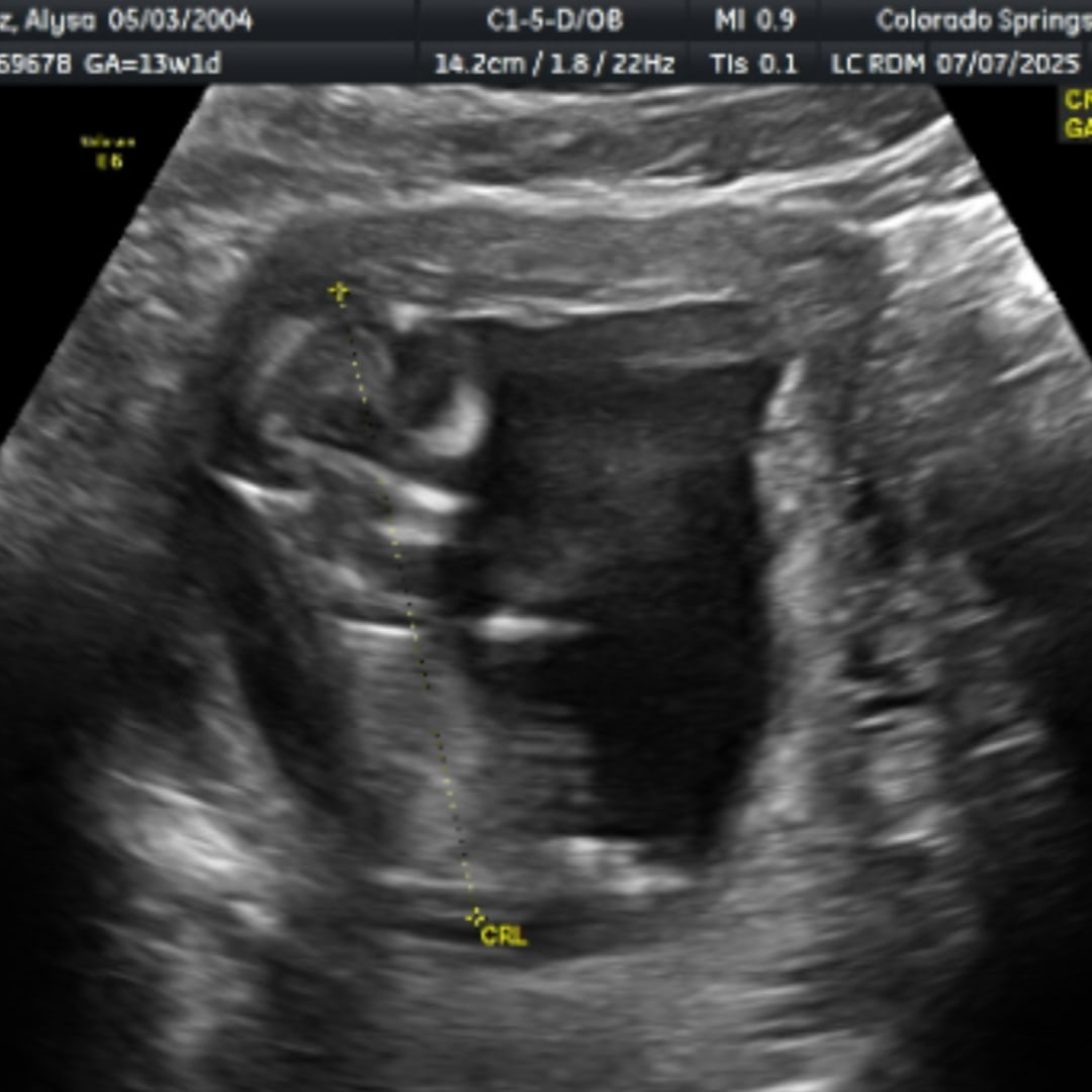 Photo shared by Alysa for their Babylist baby registry.