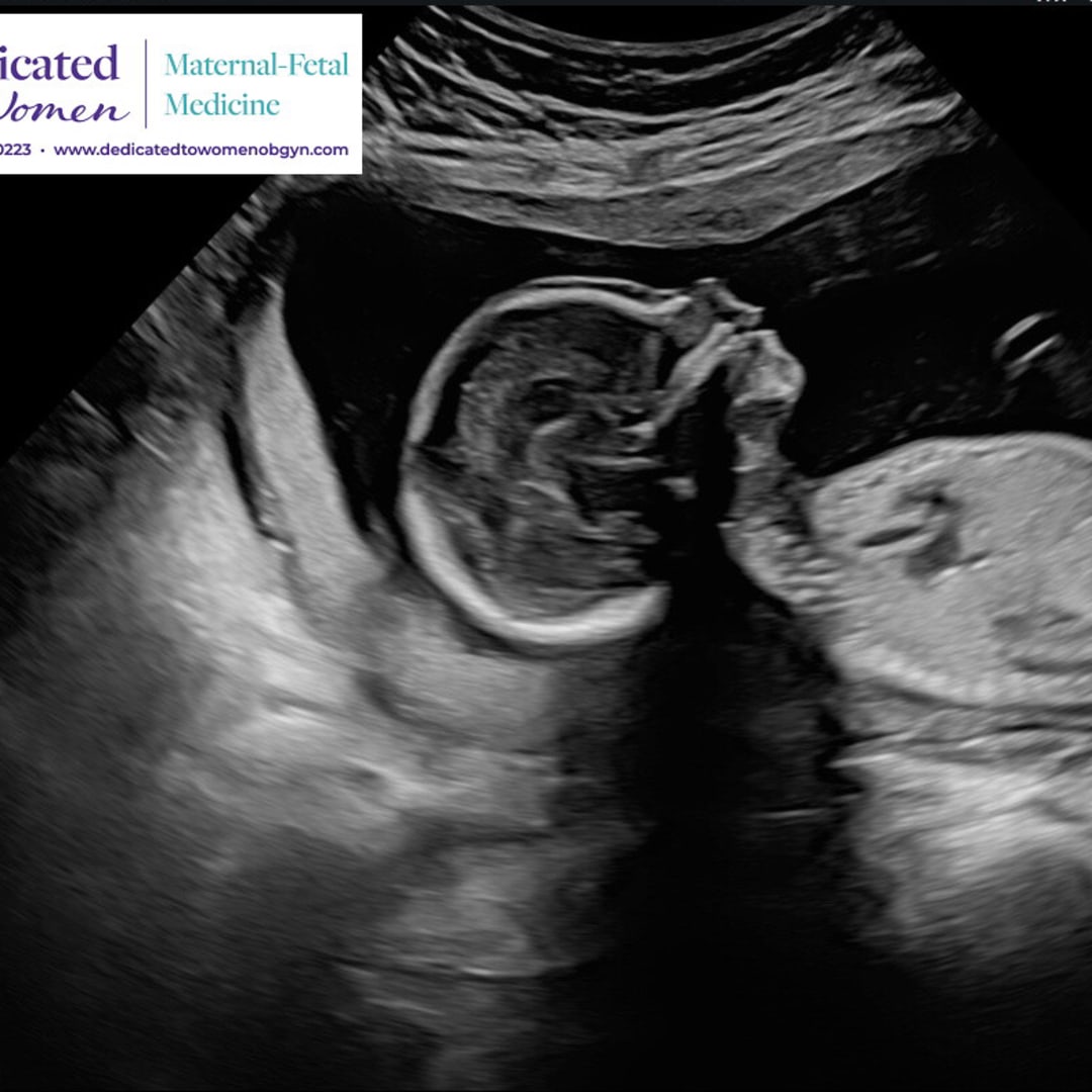 Photo shared by Tugce for their Babylist baby registry.