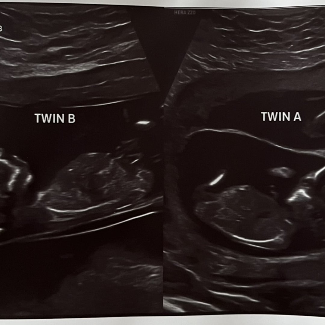 Photo shared by Abigail for their Babylist baby registry.