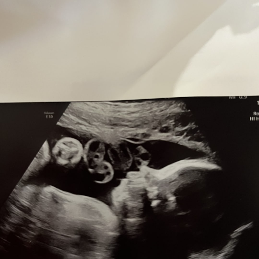 Photo shared by Brigette for their Babylist baby registry.