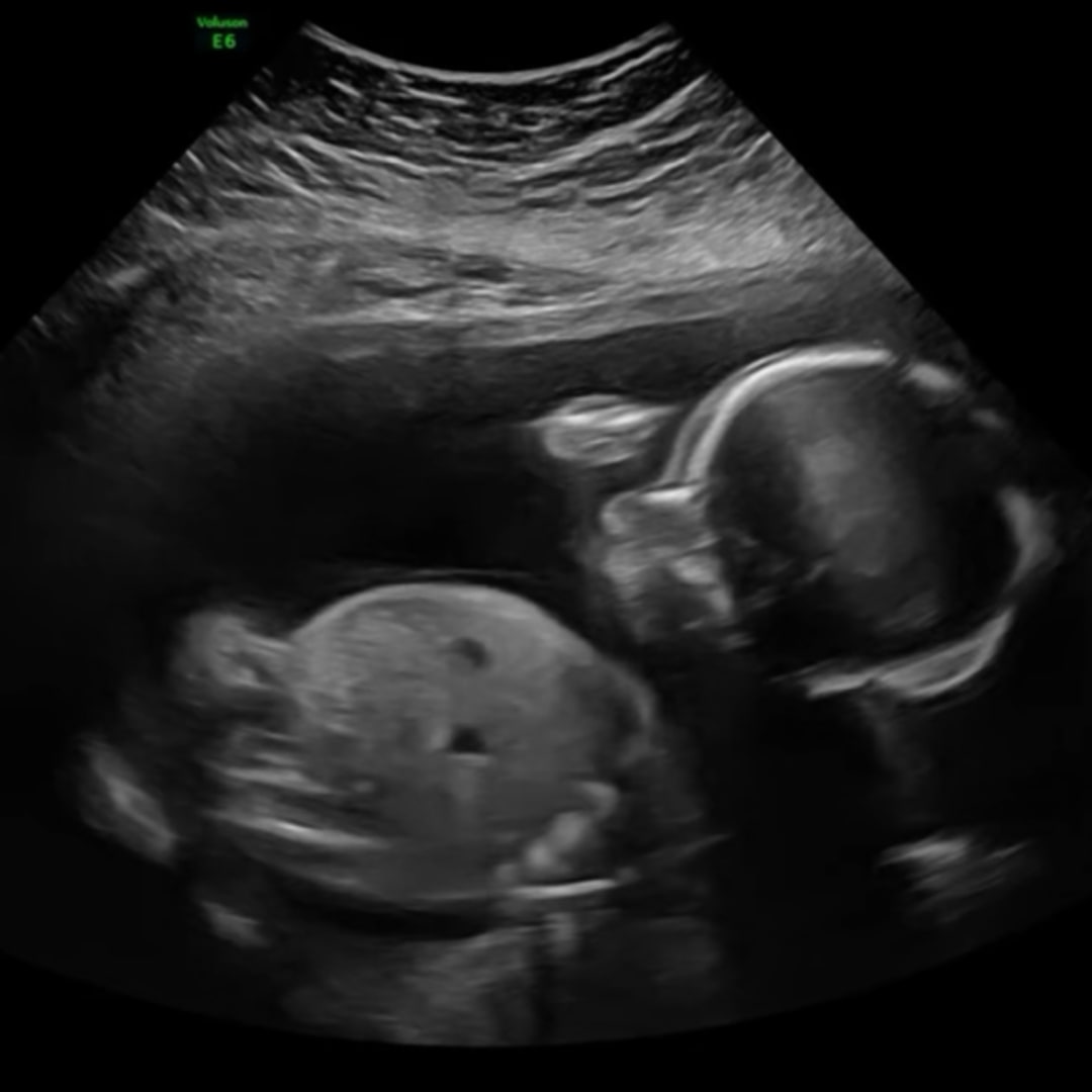 Photo shared by Jessica for their Babylist baby registry.