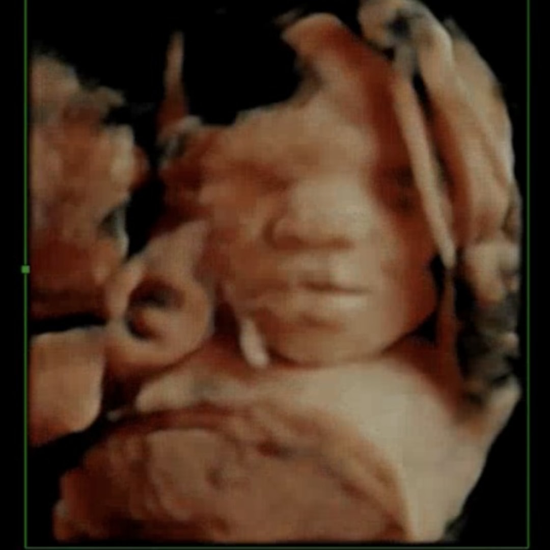 Photo shared by McKenna for their Babylist baby registry.