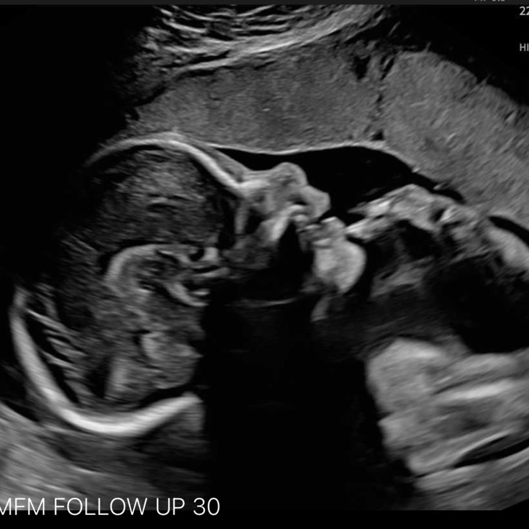 Photo shared by Devora for their Babylist baby registry.