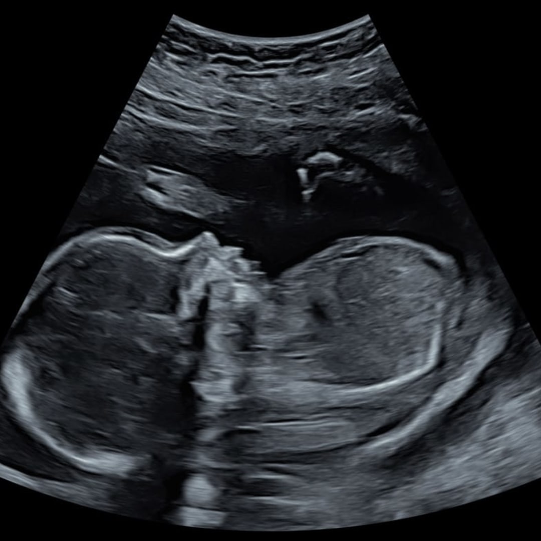 Photo shared by Monserrat for their Babylist baby registry.