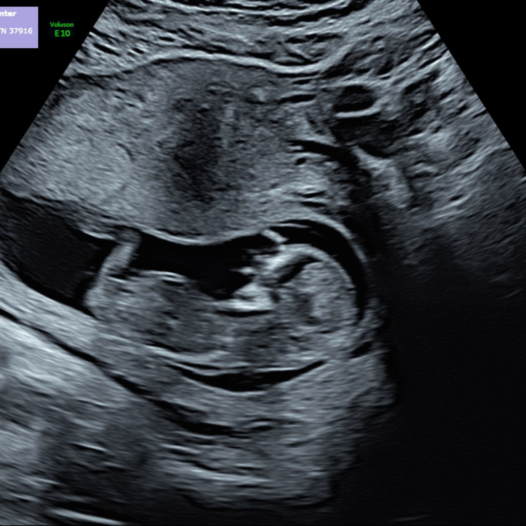 Photo shared by Emilee for their Babylist baby registry.