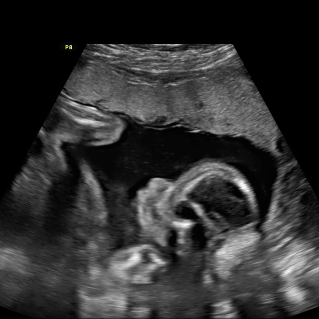 Photo shared by Caitlin for their Babylist baby registry.
