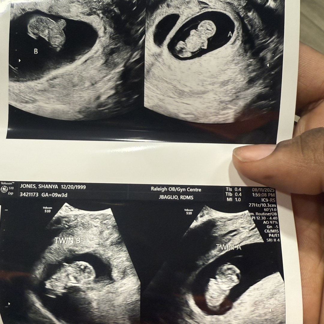 Photo shared by Nya for their Babylist baby registry.