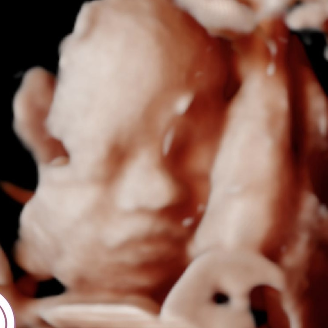 Photo shared by Michele for their Babylist baby registry.