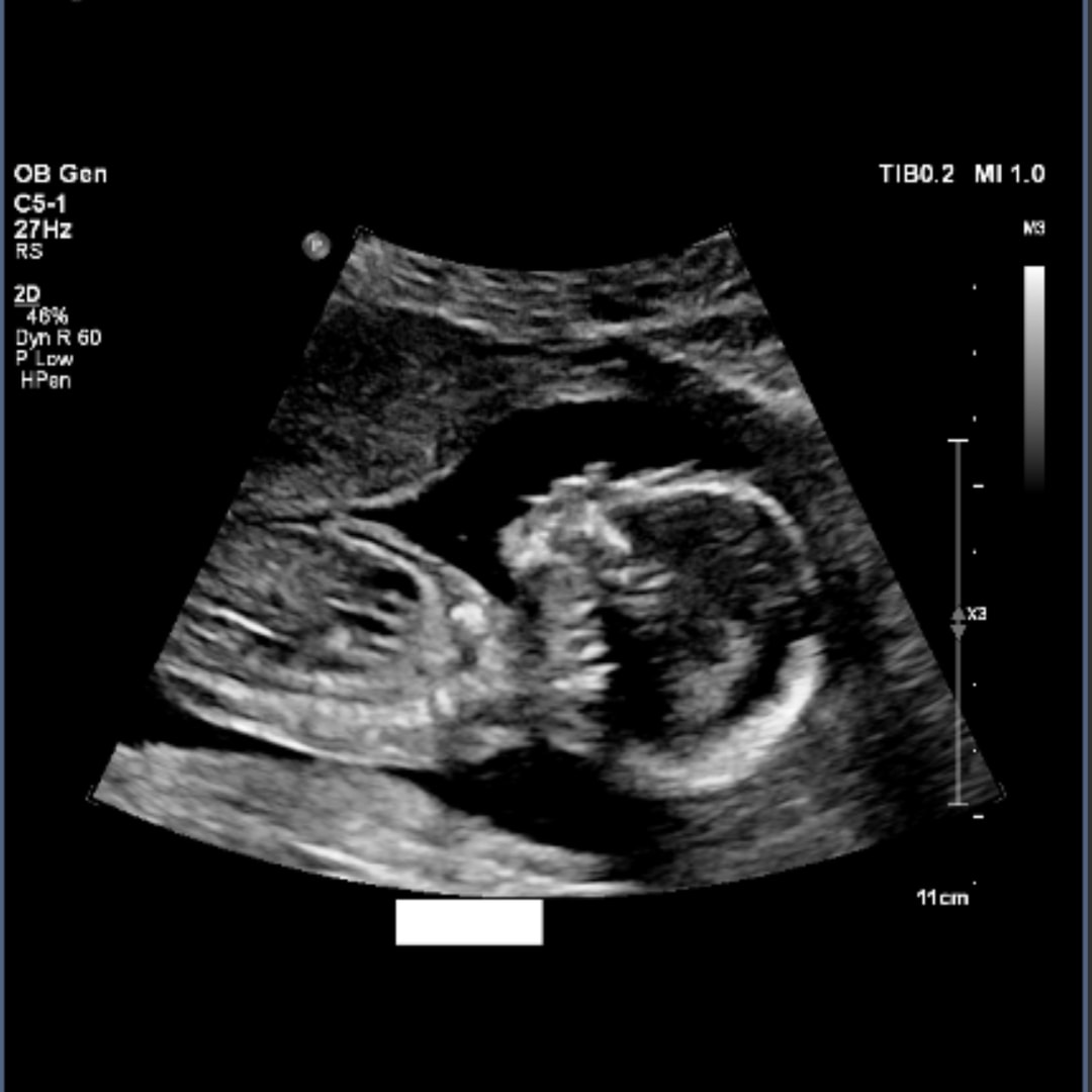 Photo shared by Jazlyn for their Babylist baby registry.