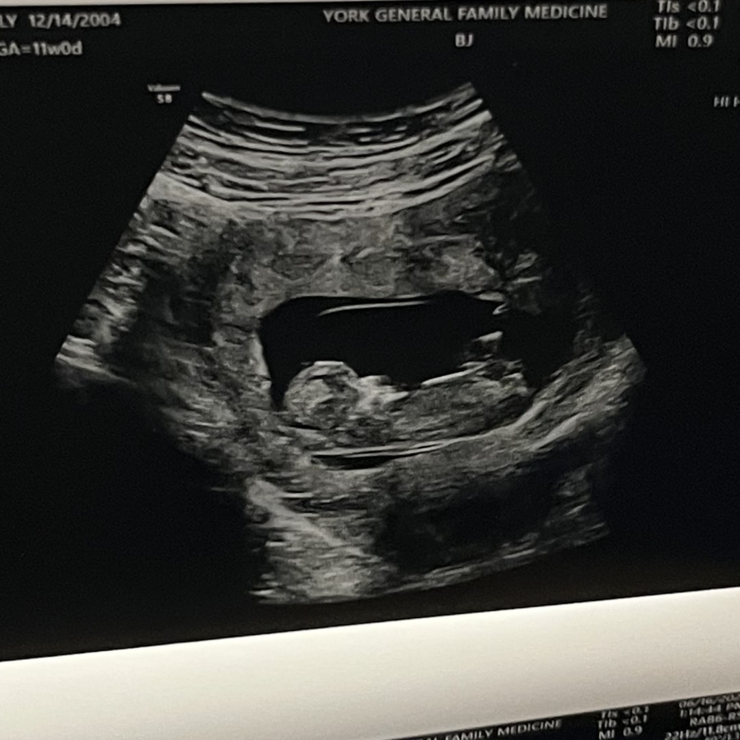 Photo shared by Christian for their Babylist baby registry.
