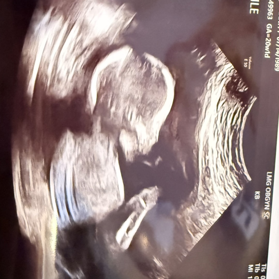 Photo shared by Khanh for their Babylist baby registry.