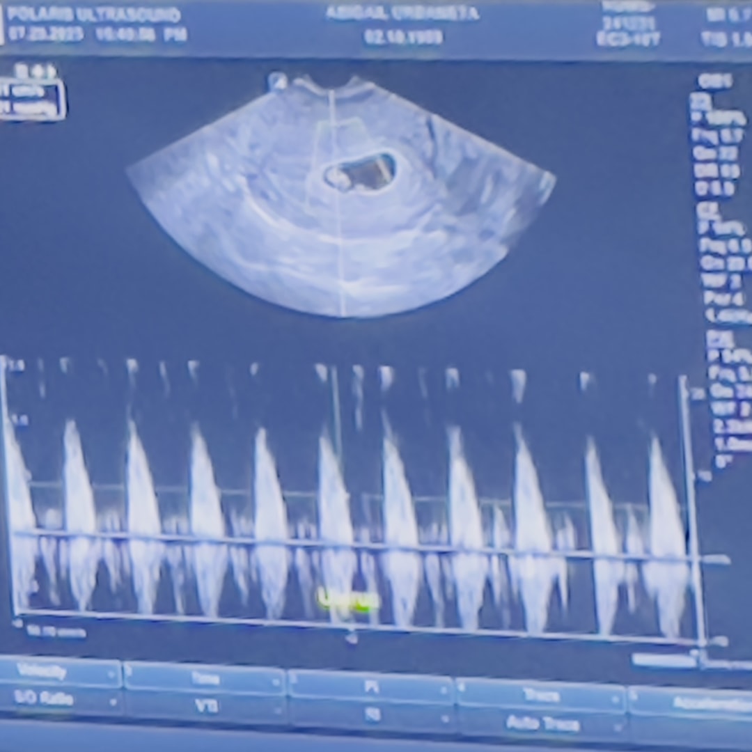 Photo shared by Abigail for their Babylist baby registry.