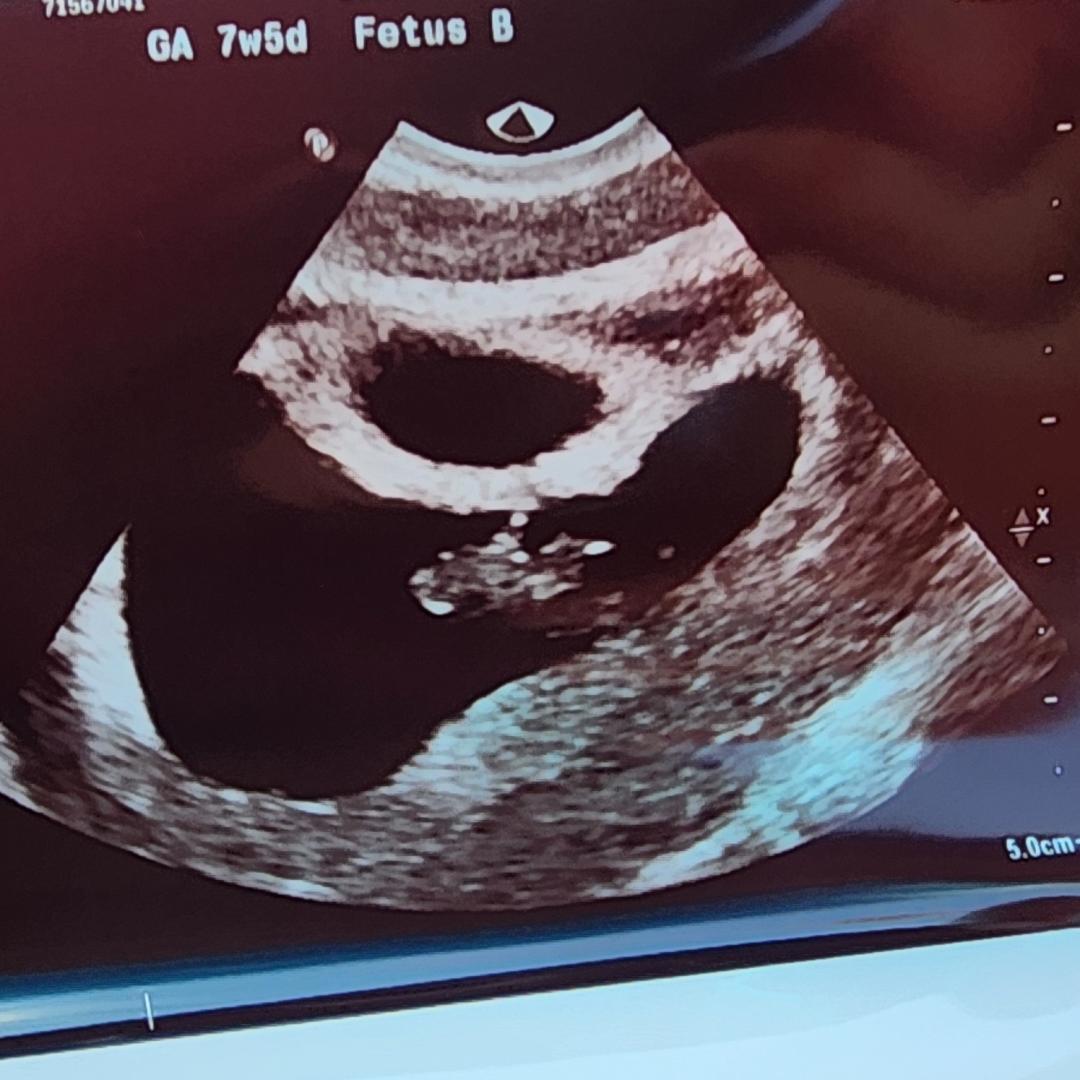 Photo shared by Casey for their Babylist baby registry.
