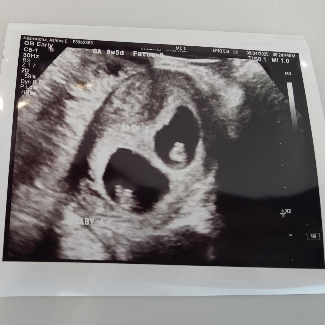 Photo shared by Ashley for their Babylist baby registry.