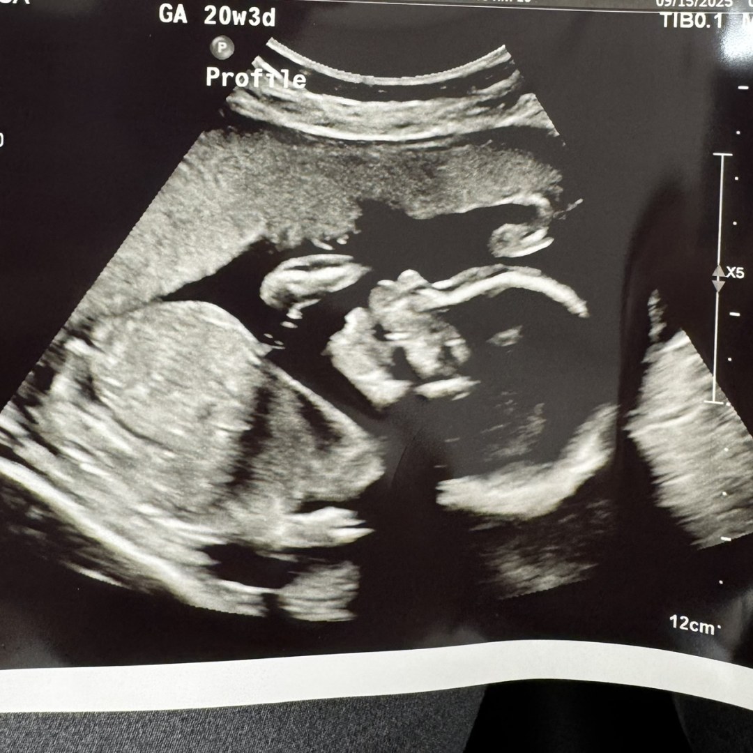 Photo shared by Rhiannon for their Babylist baby registry.