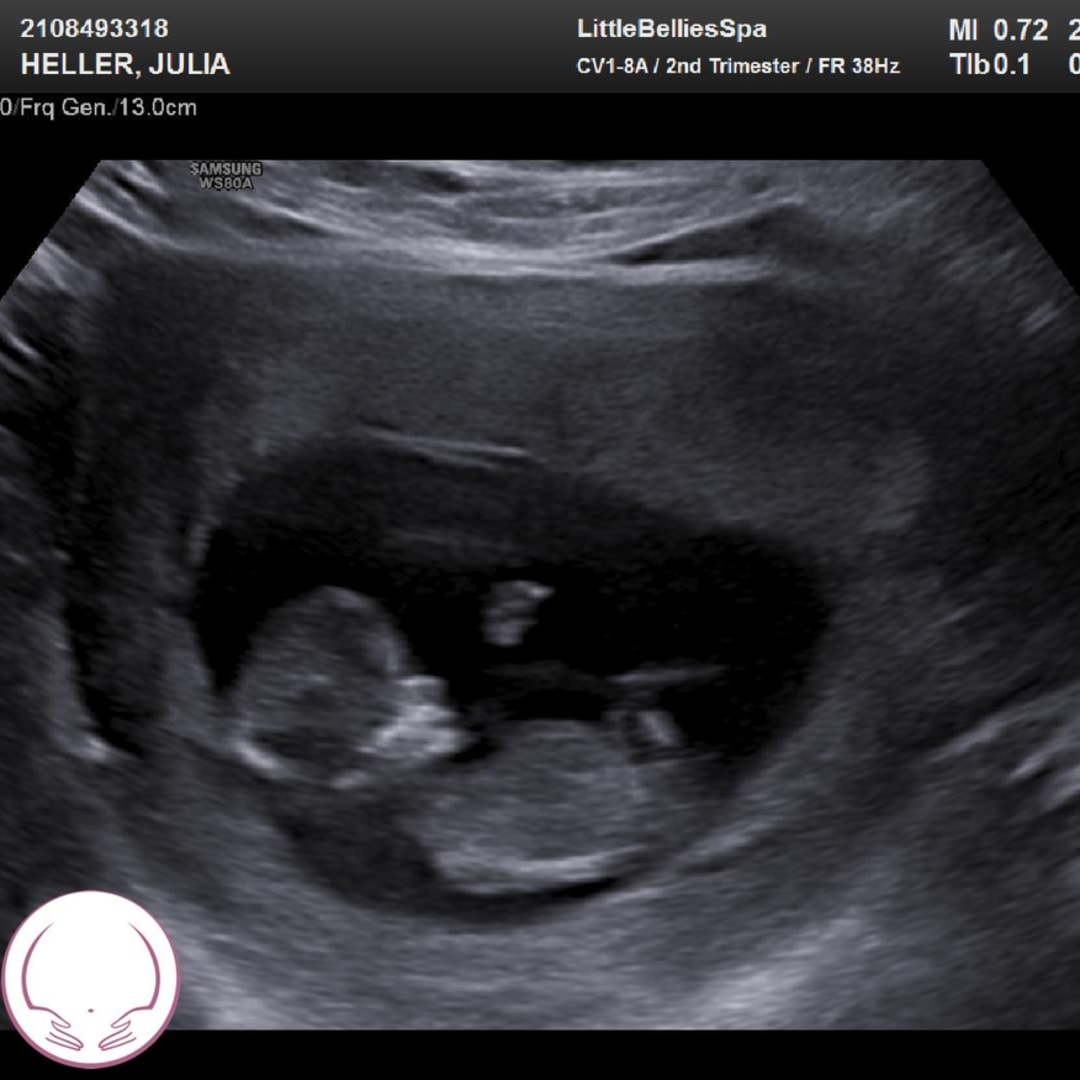 Photo shared by Julia for their Babylist baby registry.
