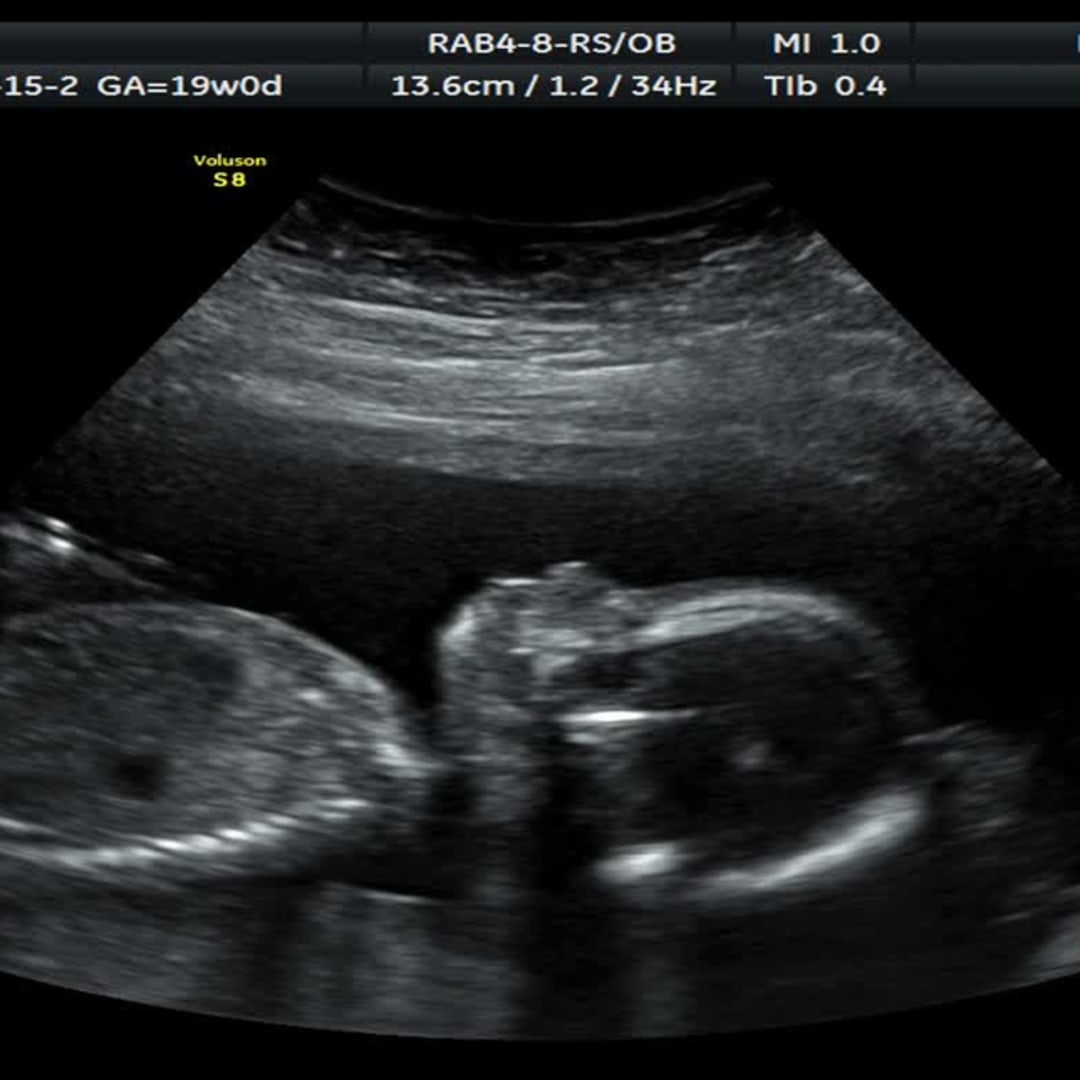 Photo shared by Bobbi Lee for their Babylist baby registry.