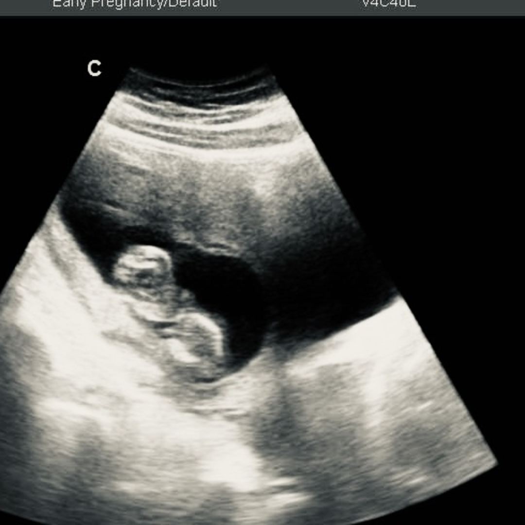 Photo shared by Molly for their Babylist baby registry.