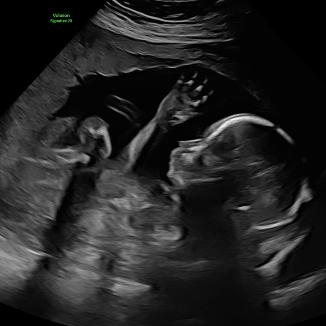 Photo shared by Shelby for their Babylist baby registry.