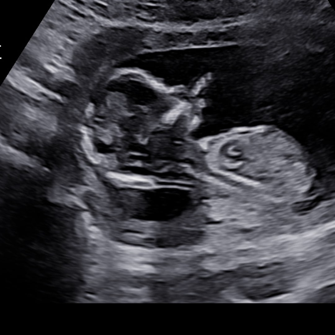 Photo shared by Will & TiNa for their Babylist baby registry.