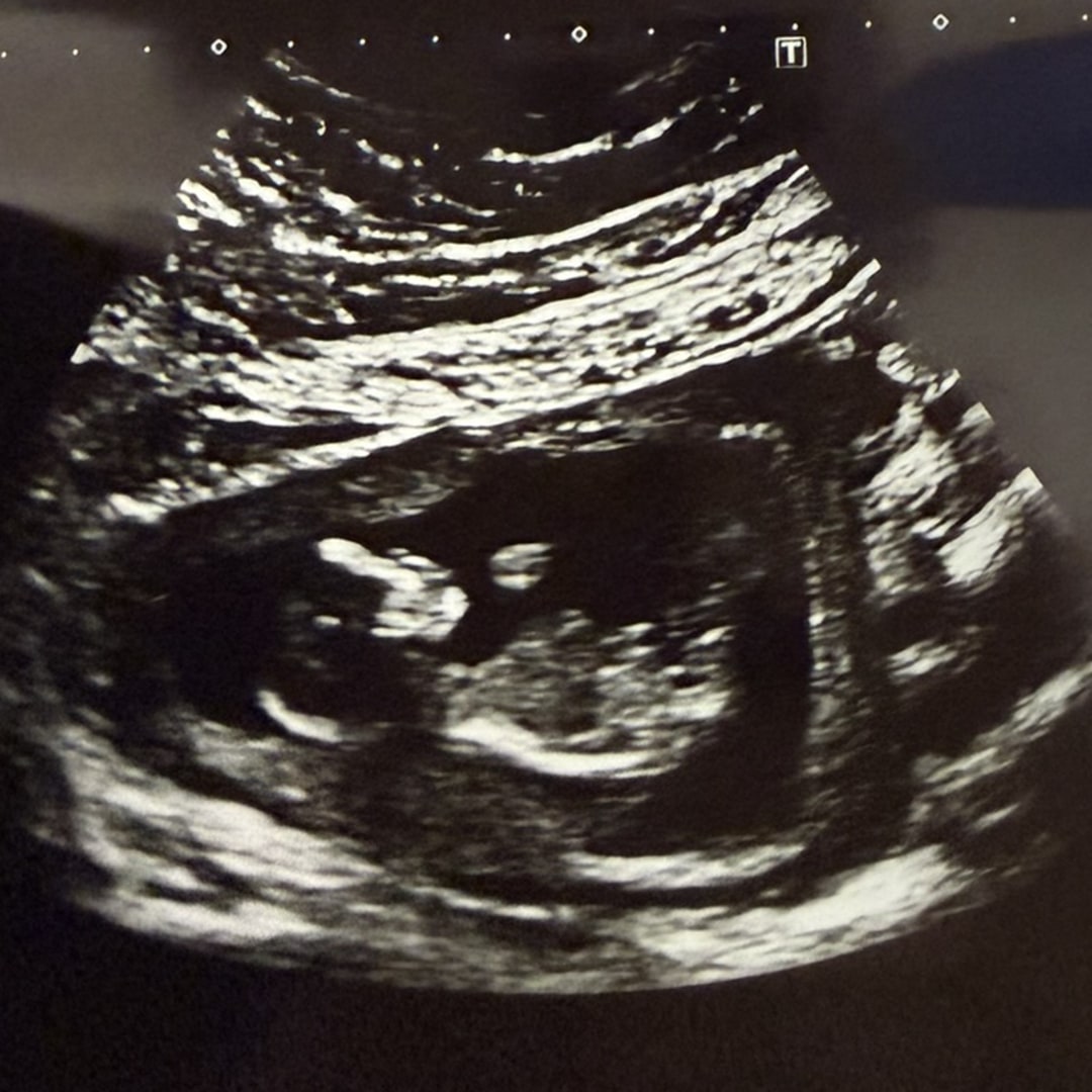 Photo shared by Angie for their Babylist baby registry.