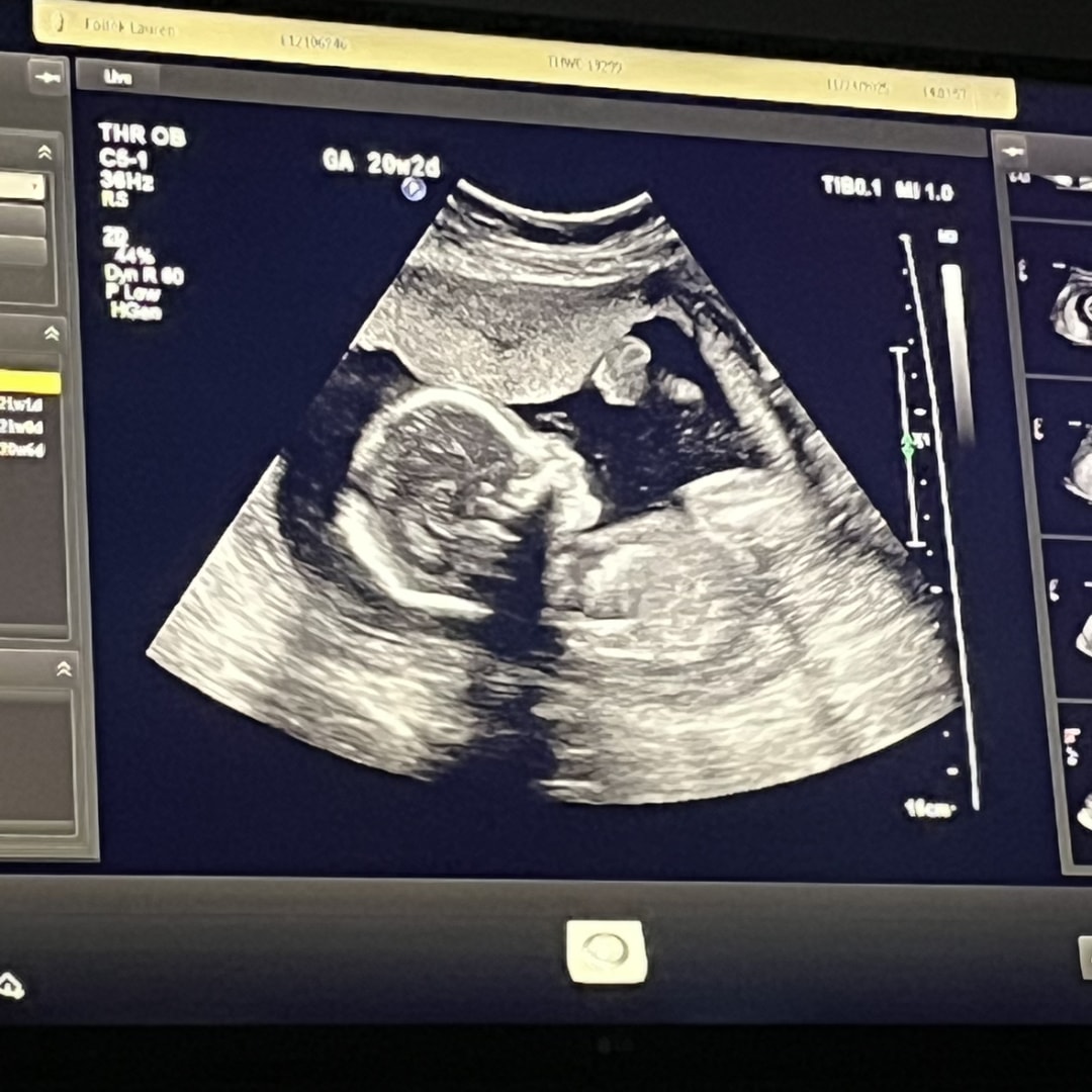 Photo shared by Lauren for their Babylist baby registry.