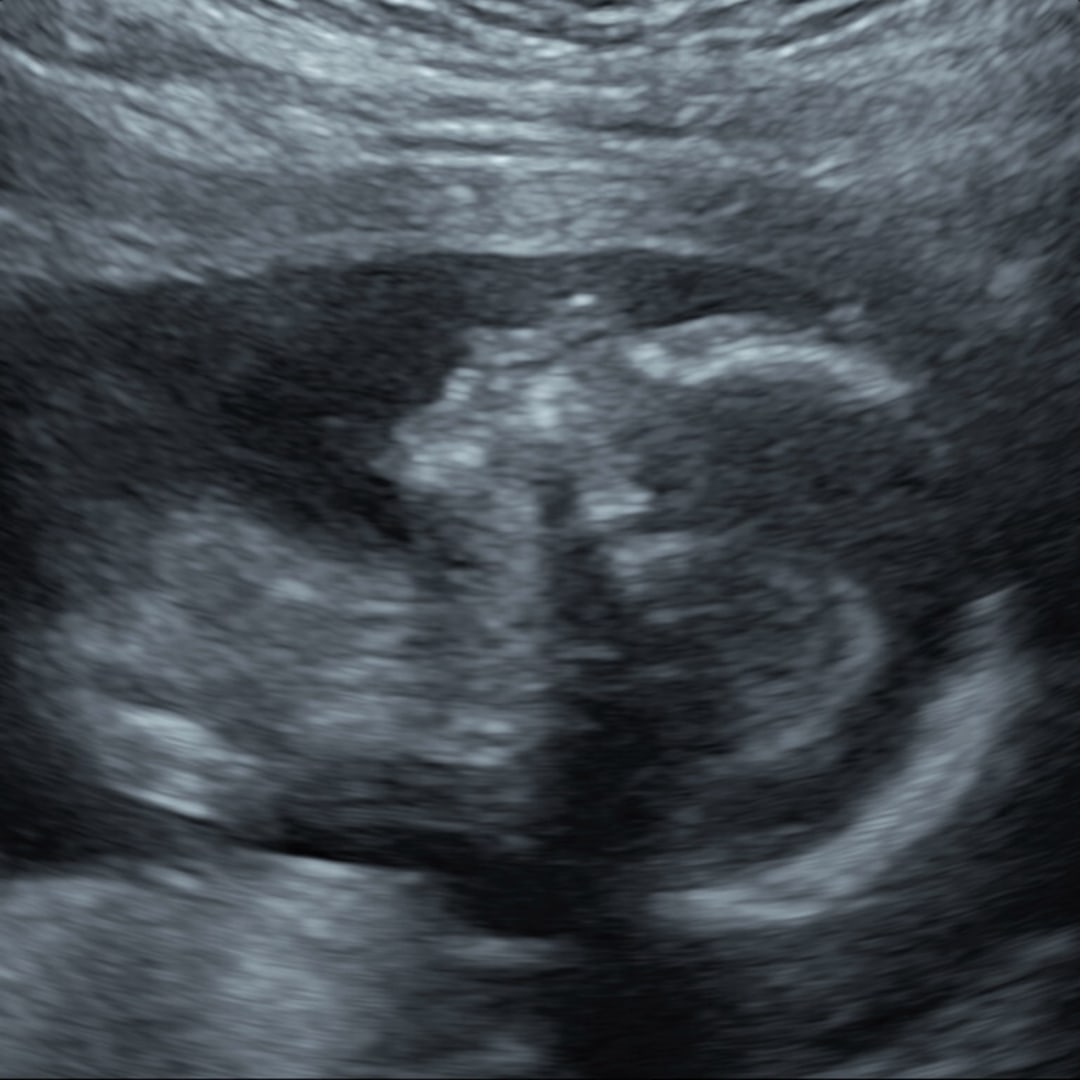 Photo shared by Rebecca for their Babylist baby registry.