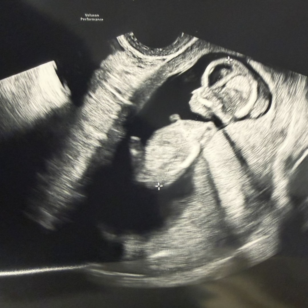 Photo shared by Bethany for their Babylist baby registry.
