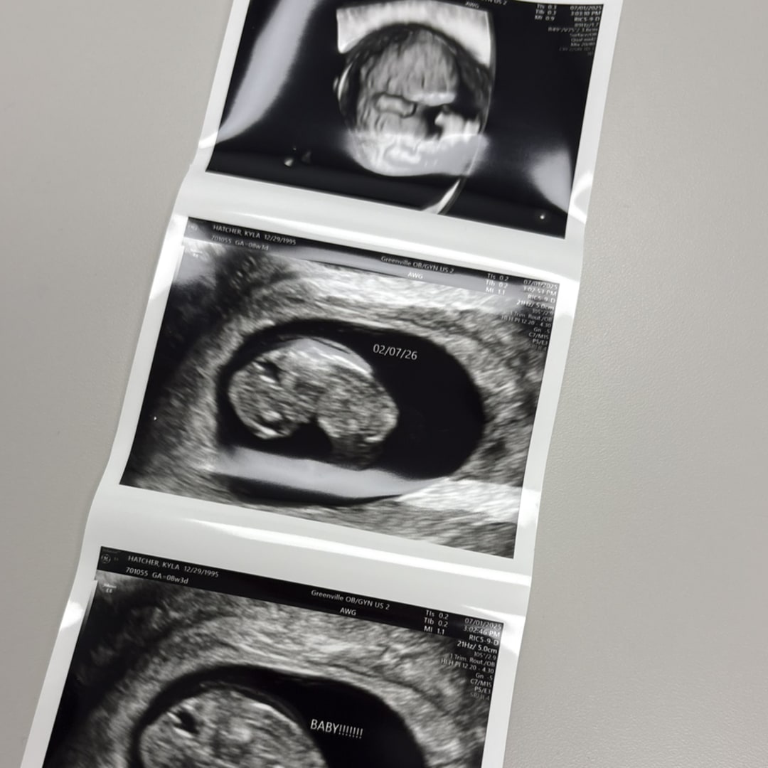 Photo shared by Kyla for their Babylist baby registry.
