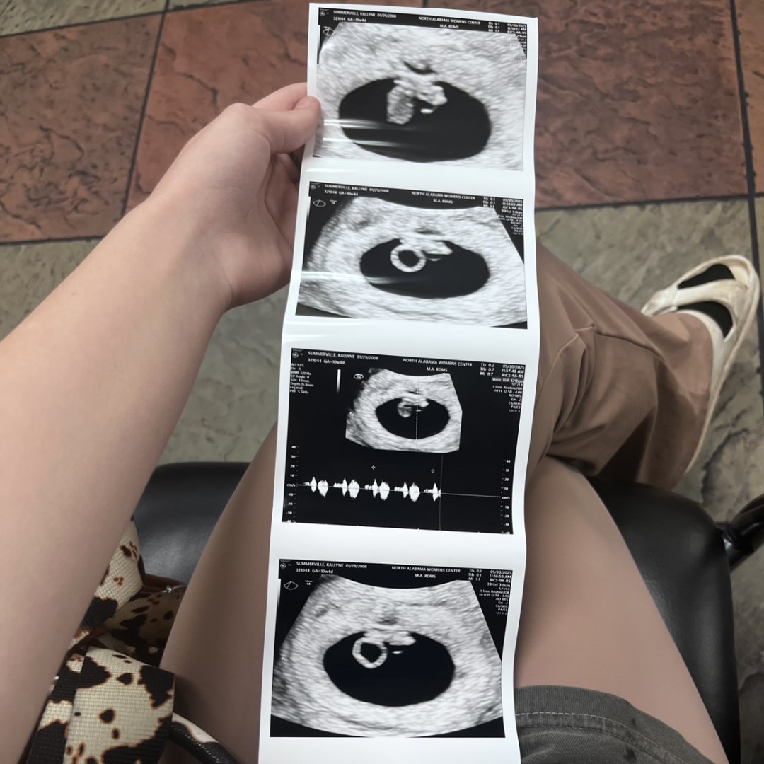 Photo shared by Kailyne for their Babylist baby registry.