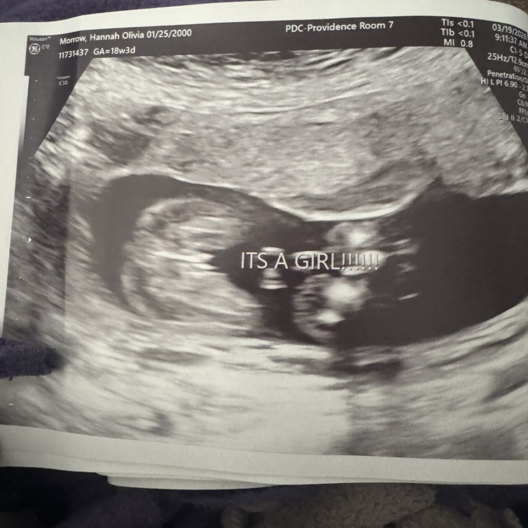 Photo shared by Hannah for their Babylist baby registry.