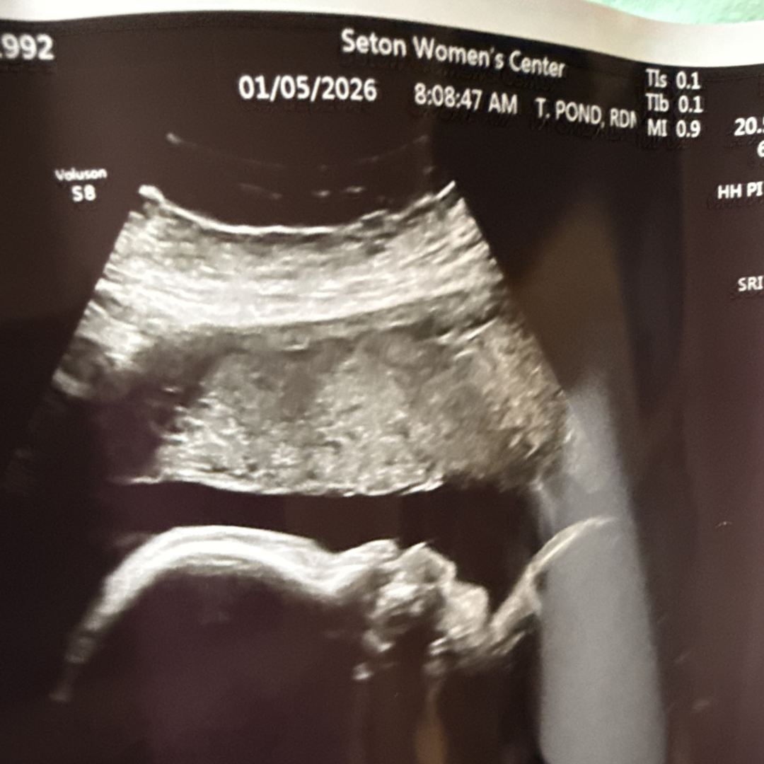 Photo shared by Celeste Kimimila for their Babylist baby registry.