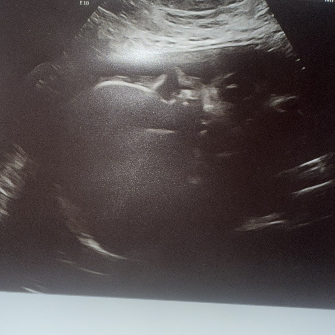 Photo shared by Crystal for their Babylist baby registry.