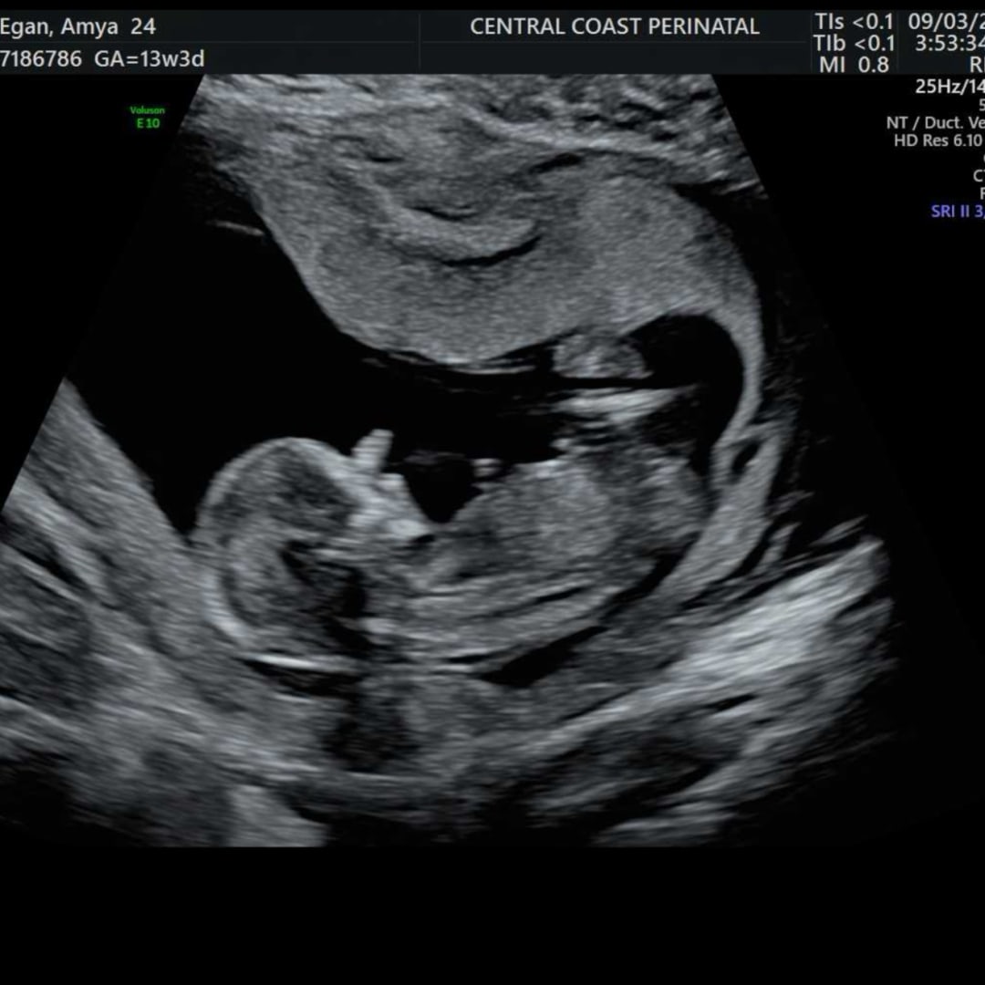 Photo shared by Amya for their Babylist baby registry.