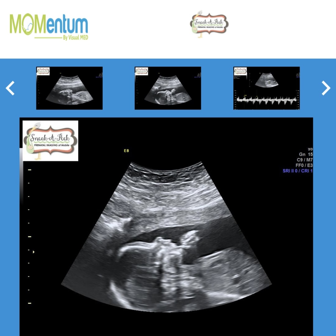 Photo shared by Haley for their Babylist baby registry.