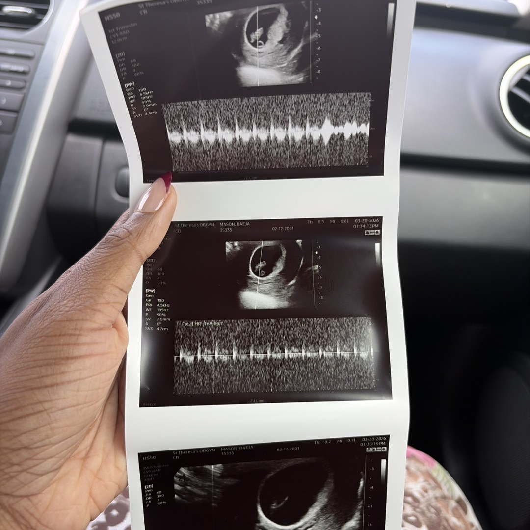 Photo shared by Daeja for their Babylist baby registry.