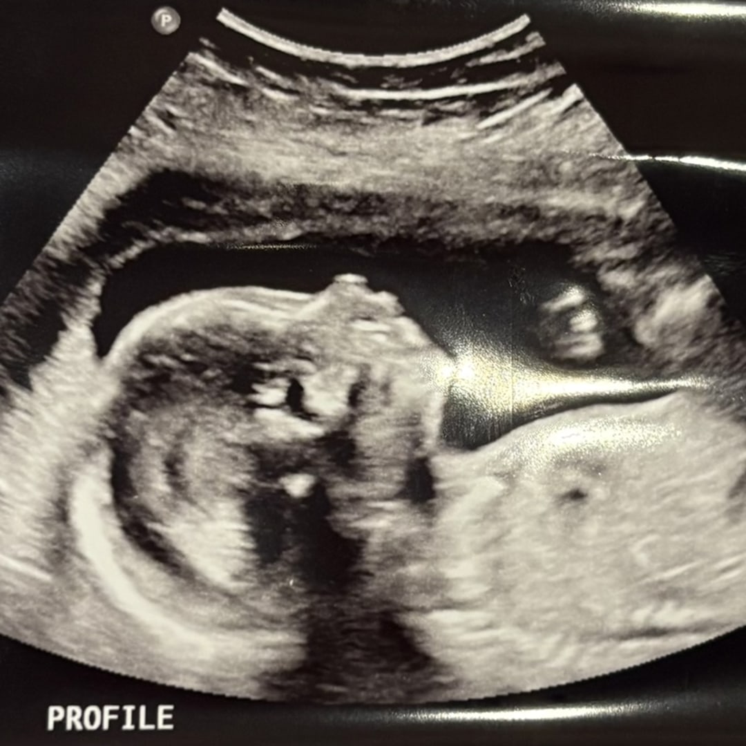 Photo shared by Hadley for their Babylist baby registry.
