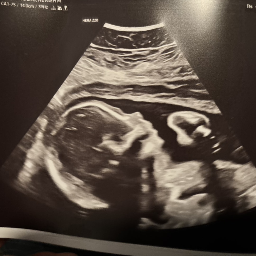 Photo shared by Ayden & Nevaeh for their Babylist baby registry.