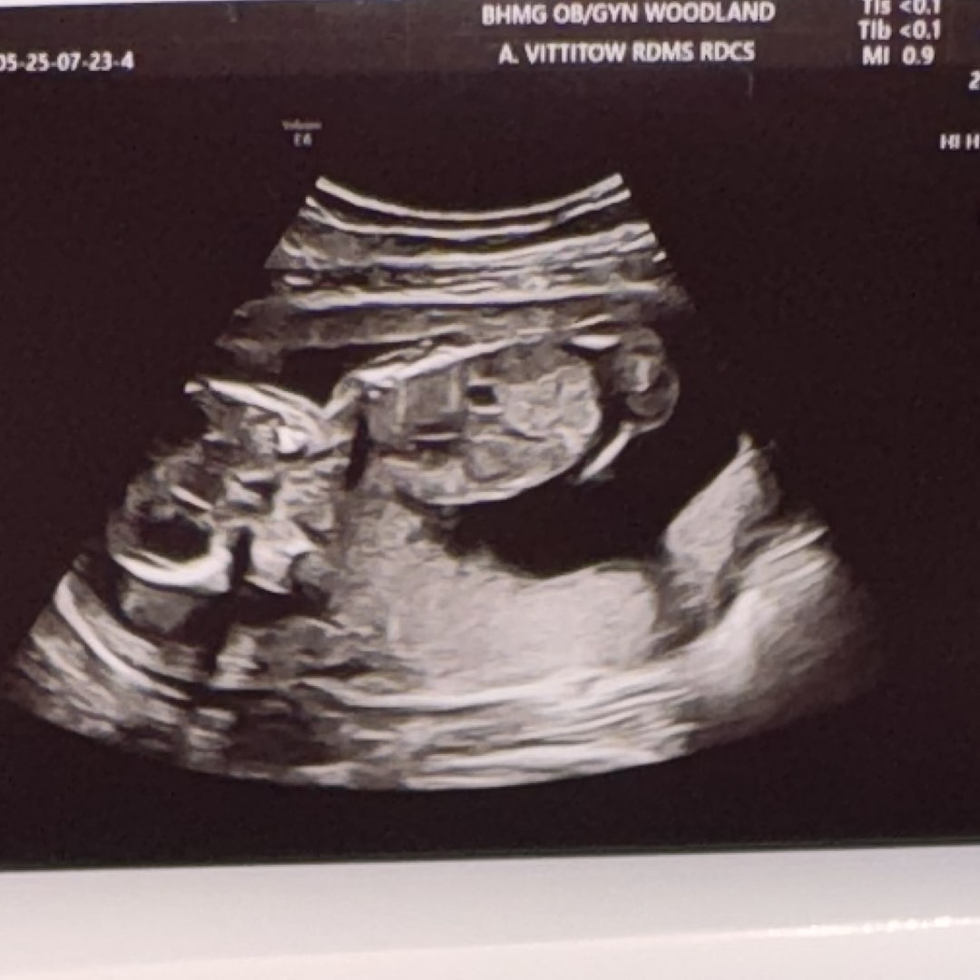 Photo shared by Moe for their Babylist baby registry.