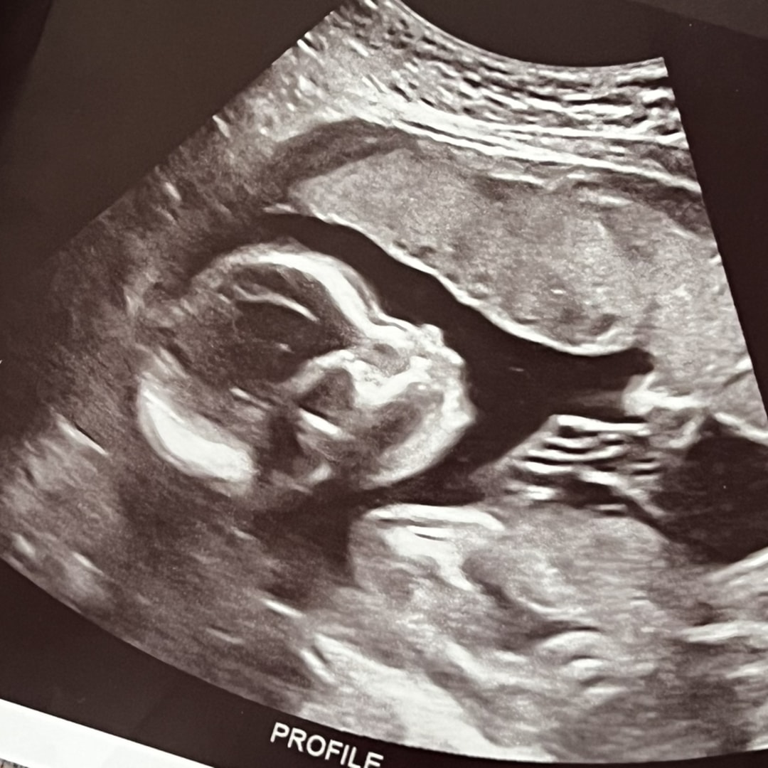 Photo shared by Savannah for their Babylist baby registry.