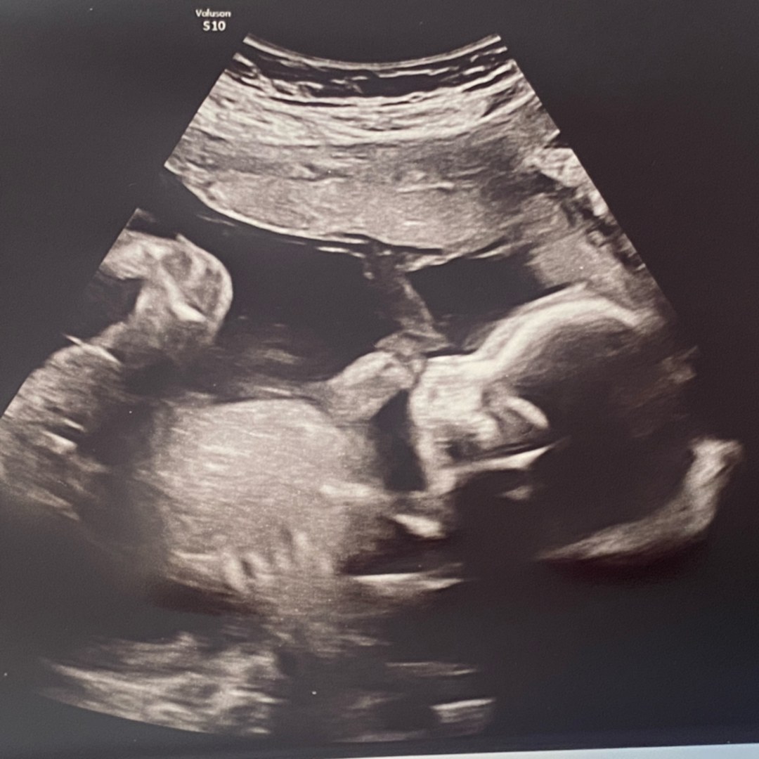 Photo shared by Lindsay for their Babylist baby registry.