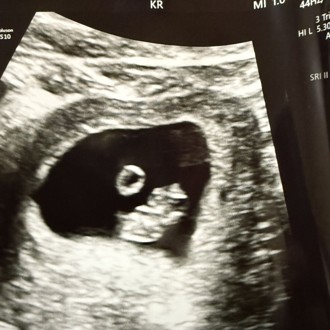 Photo shared by Haley for their Babylist baby registry.