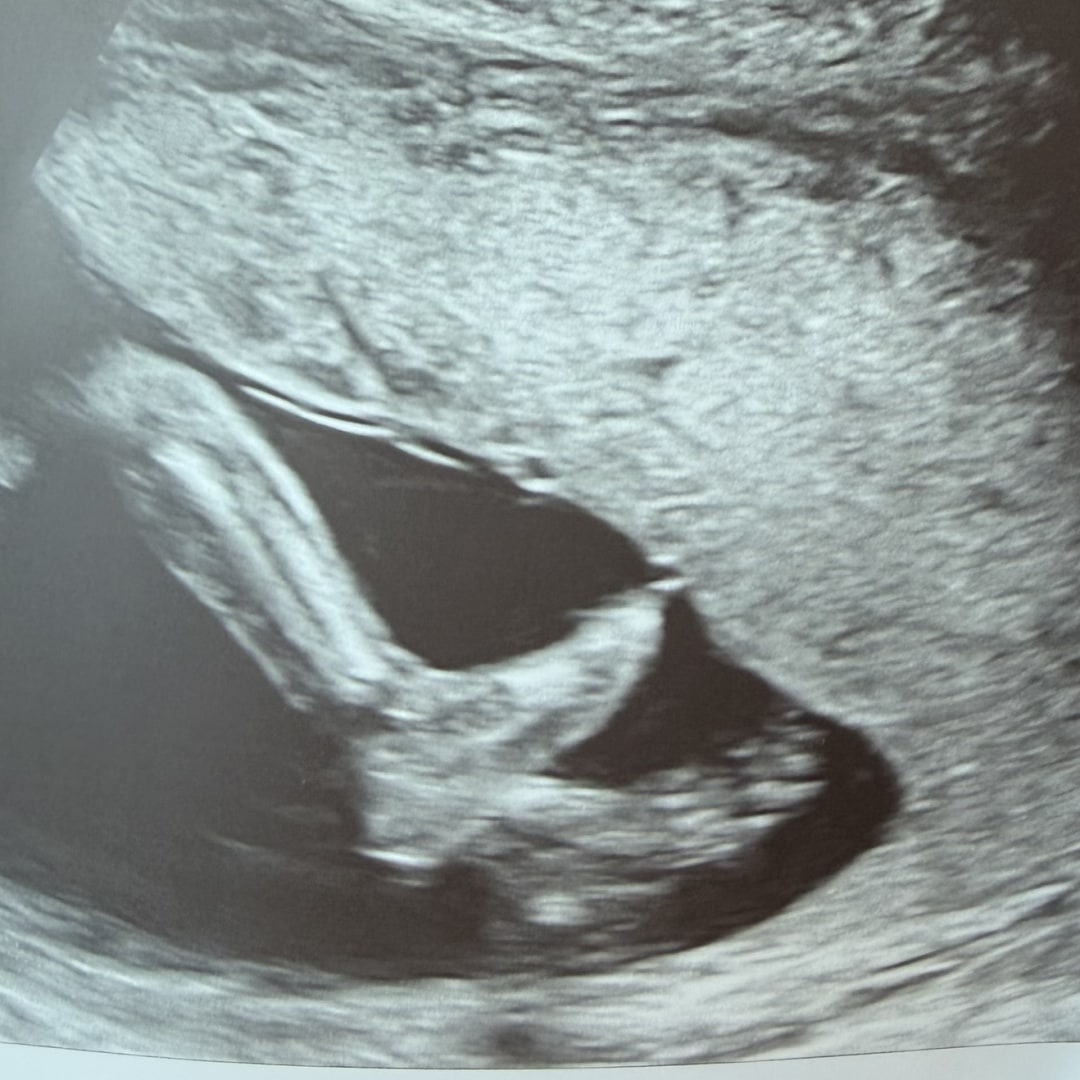 Photo shared by Ilsi for their Babylist baby registry.